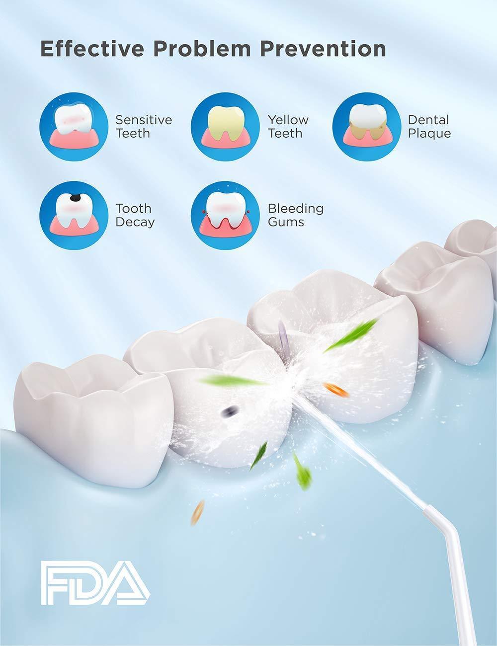 PeriFloss - Portable Oral Irrigator Flosser