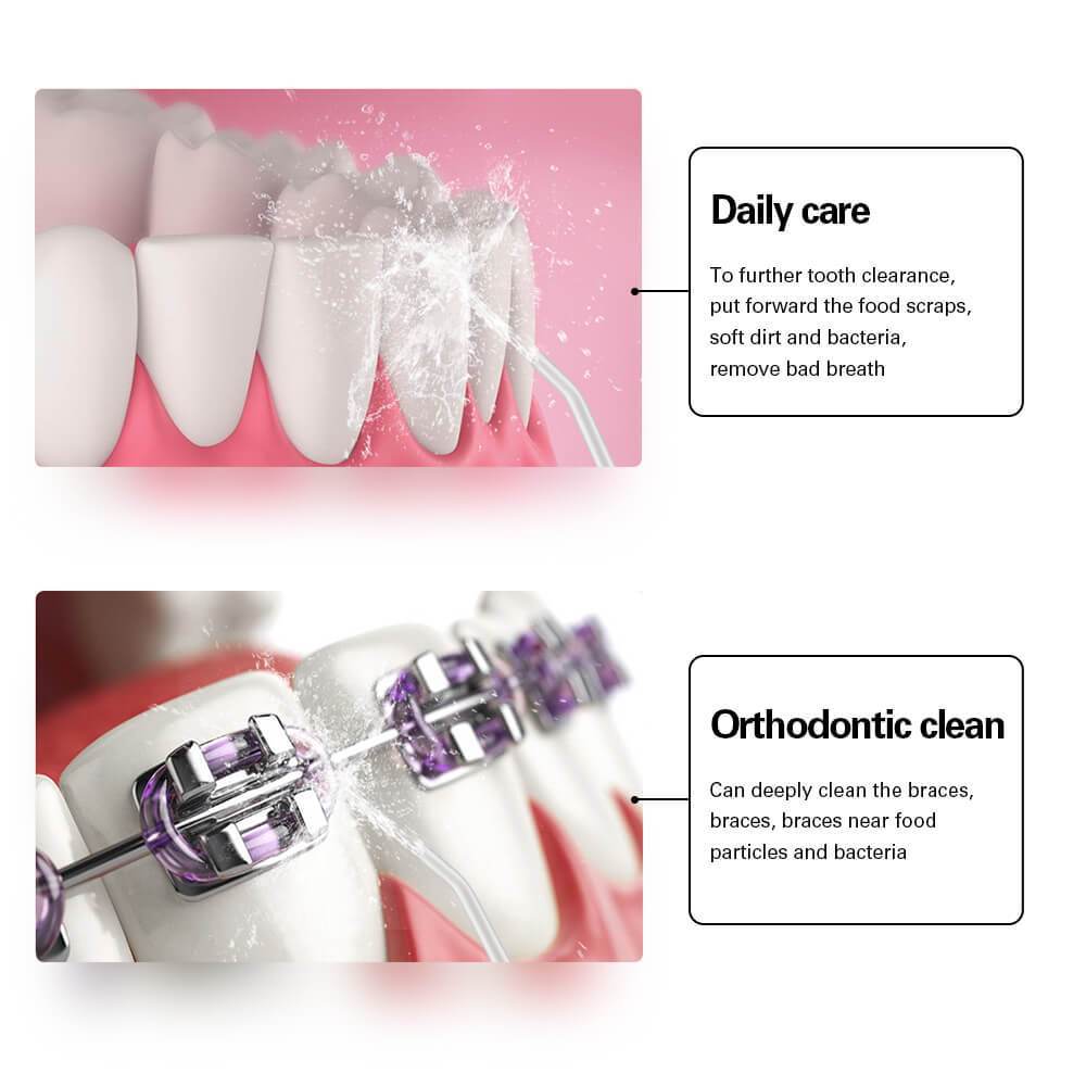 PeriFloss - Portable Oral Irrigator Flosser