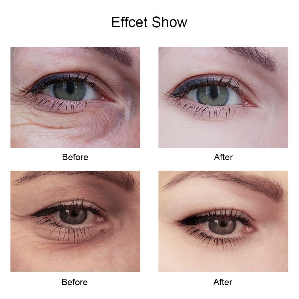 24K Collagen Eye Restoration (60 Patches)