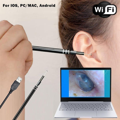 USB Ear Cleaning Endoscope (WIFI Version)- For IOS & Android